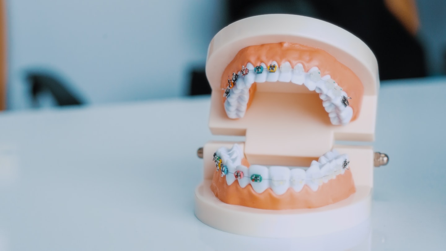 Modelo demonstrativo de aparelho dental