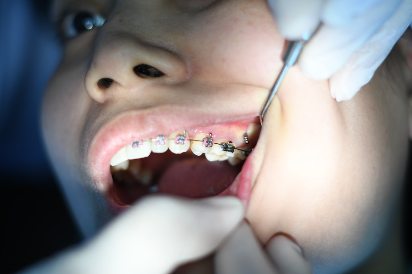 Atendimento odontológico, imagem ilustrativa