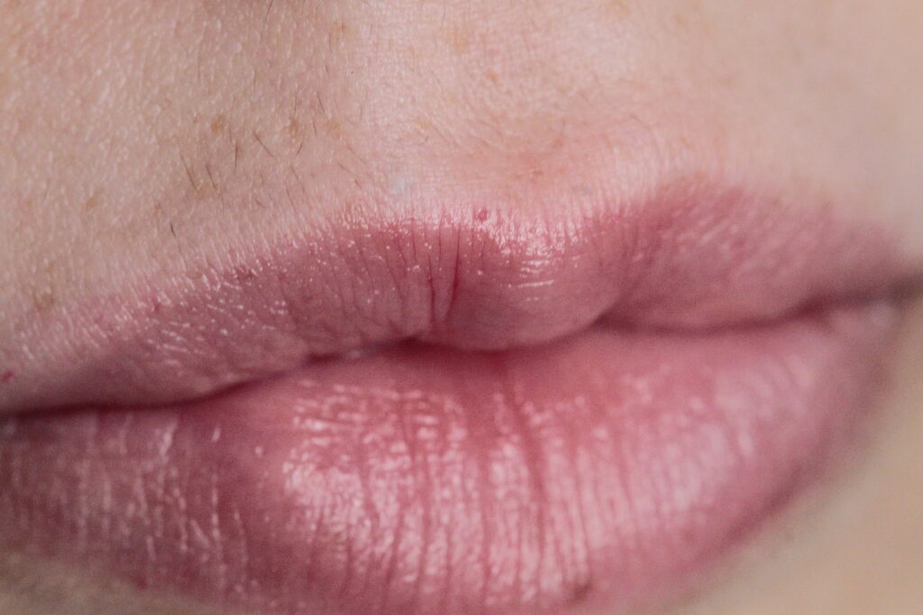 Imagem ilustrativa de estética orofacial